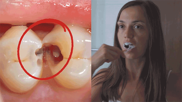 Simple daily ProvaDent oral care routine demonstration